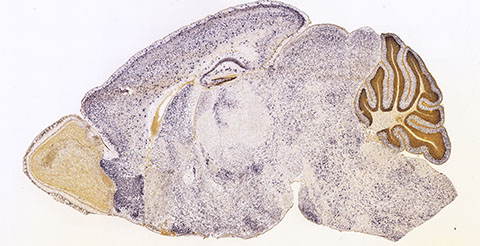 In contrast to in situ hybridization experiments like this one, which shows where in the mouse brain a single transcript is located, spatial transcriptomics experiments can give researchers information about the whereabouts of many transcripts at once.