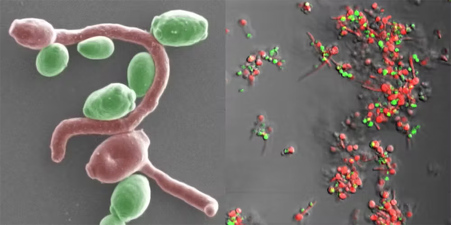 This image shows Candida albicans (red) producing branching filaments that allow it to attach to Candida glabrata (green), forming biofilms. Both of these species can cause infections in people.