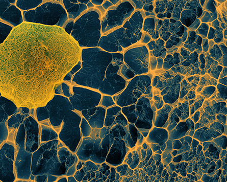 A colorized image of a human stem cell (yellow) embedded within a 3D matrix that mimics the bone marrow environment, as captured by cryo-scanning electron microscopy.