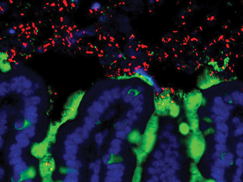 Gut-bacteria-800x600.jpg Gut-bacteria-800x600.jpg