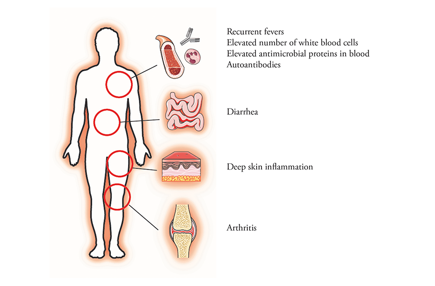 a-chain-of-events-otulin-cartoon-body-fullcol.png a-chain-of-events-otulin-cartoon-body-fullcol.png