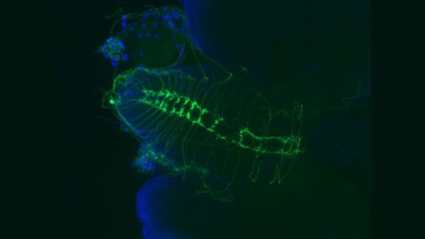 This fruit fly brain shows the mutation the new study links to muscular dystrophies. The fly has wiring defects in sensory axons, pictured in fluorescent green. (Image courtesy of Pedro Monagas-Valentin)