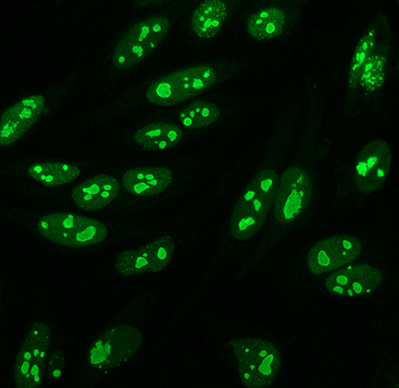 MCP-FtJ-ANA_NUCLEOLAR-445x433.jpg MCP-FtJ-ANA_NUCLEOLAR-445x433.jpg