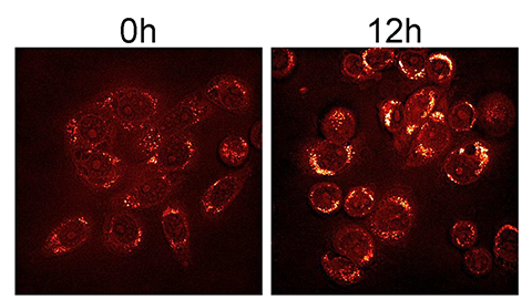 Starved to death: Can dietary methionine combat cancer?