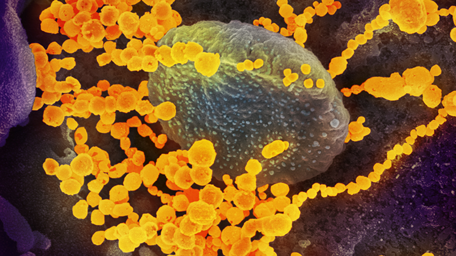 A small army of researchers races to build a coronavirus interactome
