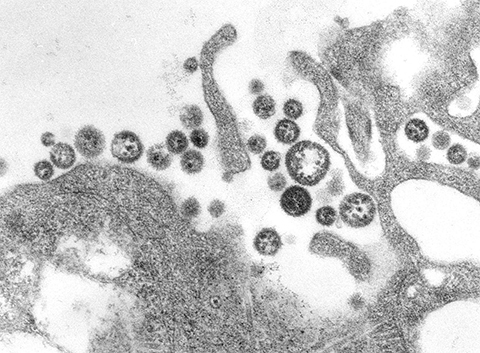 A transmission electron micrograph of a number of Lassa virus virions adjacent to cell debris. The virus causes Lassa fever.