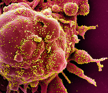 Coronavirus-445x383-1.jpg Coronavirus-445x383-1.jpg