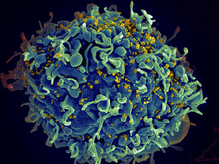 JBC-HIV-infected-T-cell-445x334.jpg JBC-HIV-infected-T-cell-445x334.jpg
