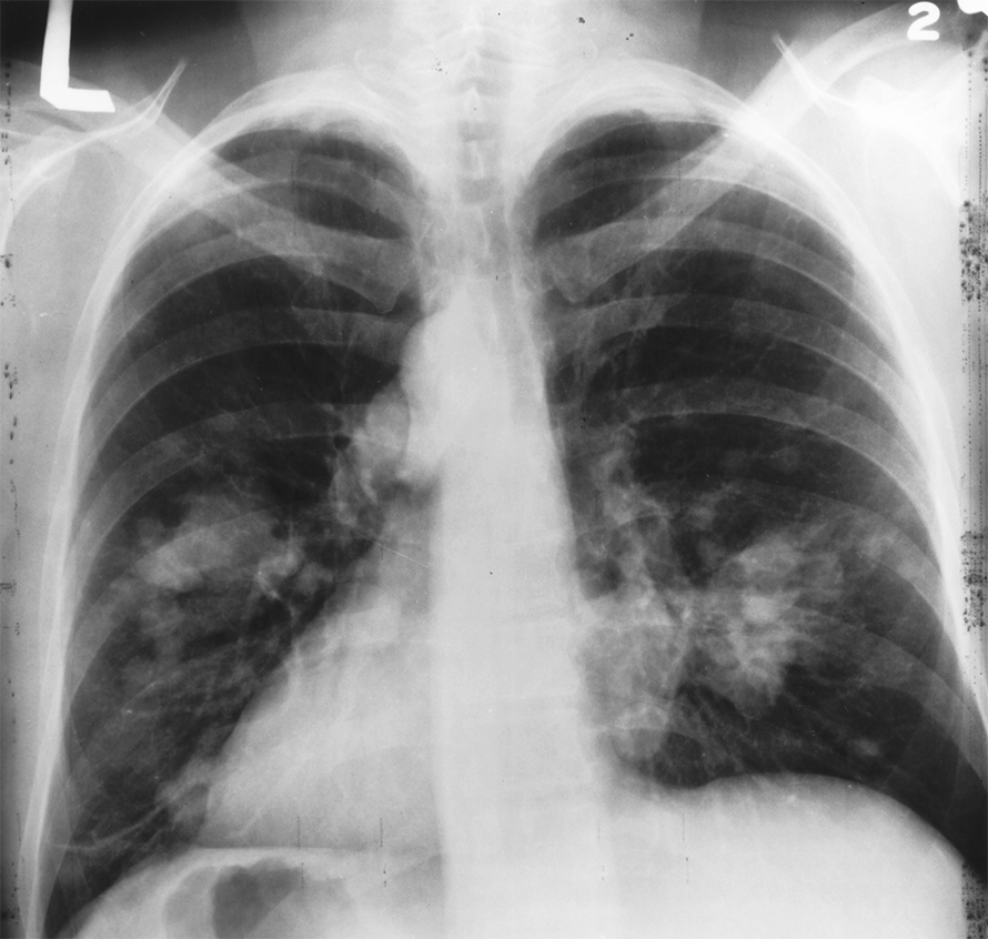 X-Ray-890x846.jpg