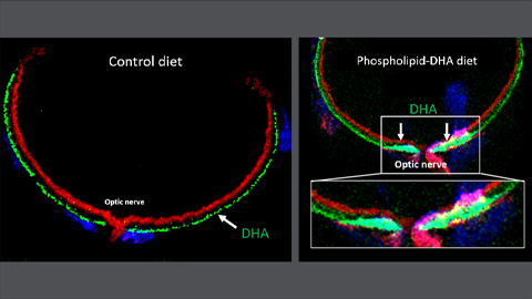 Vision health depends on critical fat intake