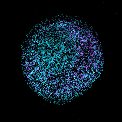 This image of a 2D crryosection of a human brain organoid isstained with DAPI (teal) and VIPR2 (magenta).