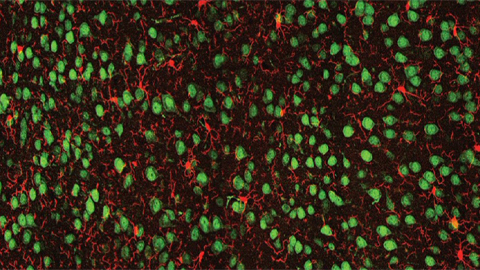 Sex, immunity and the brain