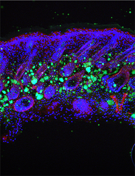 Fat-cells-NIH-445x577.jpg