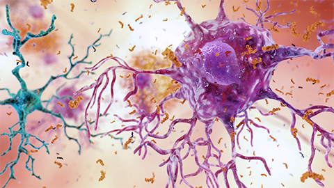 Could the immune system be key to Alzheimer’s disease?
