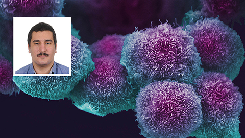 Researchers unmask a pancreatic cancer culprit