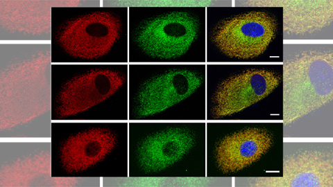 ELOVL4 mutations: Two sides of the same coin