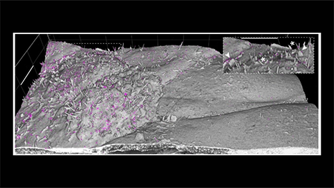 Expansion microscopy ‘grows’ samples larger for super-resolution imaging
