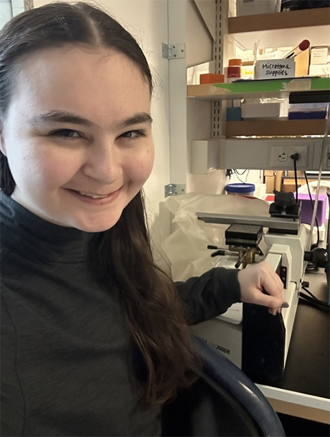 Taylor Stolberg is postbaccalaureate researcher at the University of Michigan Medical School studying the brain disorder spinocerebellar ataxia type 3.