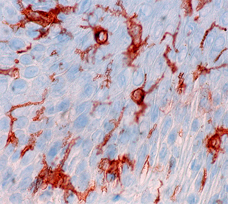 Langerhans-Cells-445x398.jpg Langerhans-Cells-445x398.jpg