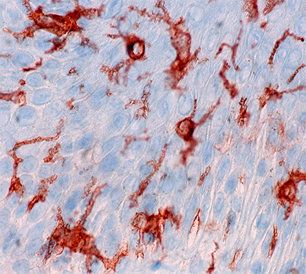 Langerhans-Cells-445x398.jpg