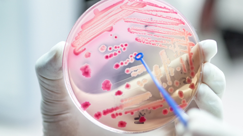 Antibiotic resistance is at a crisis point