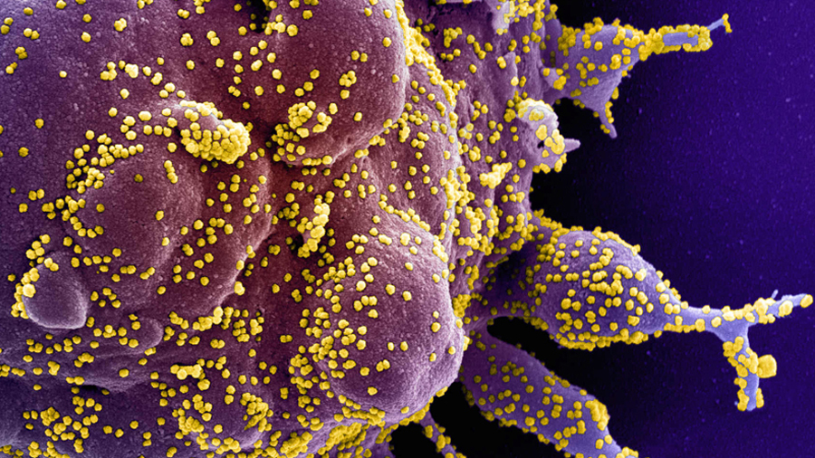 Will the coronavirus evolve to be less deadly?