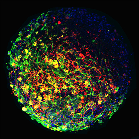 MiniBrain-445x445.jpg MiniBrain-445x445.jpg