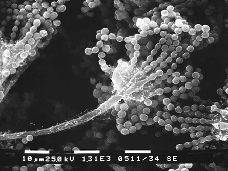 Mold-445x334.jpg Mold-445x334.jpg