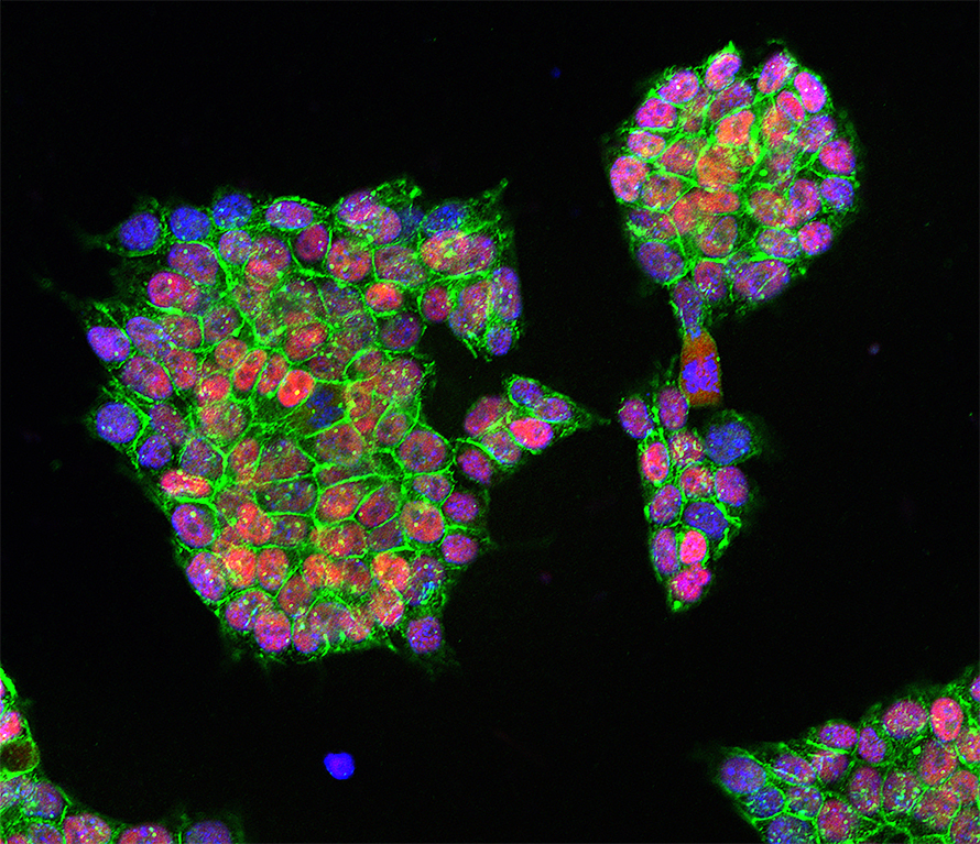 Microscopy image of mouse embryonic stem cell colonies labelled for E-cadherin, a structural protein, (green); nanog, a stem cell transcription factor, (pink); and cell nuclei (blue).
