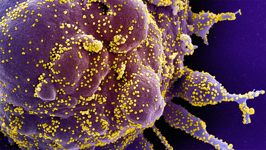 Corona-virus-890x501.jpg Corona-virus-890x501.jpg