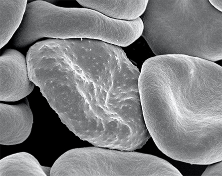 Red-blood-cells-445x353-1.jpg Red-blood-cells-445x353-1.jpg