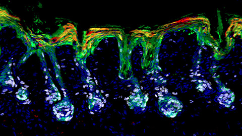Vitamin A may play a central role in stem cell biology and wound repair