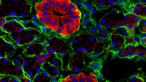 The quest to treat and cure xerostomia