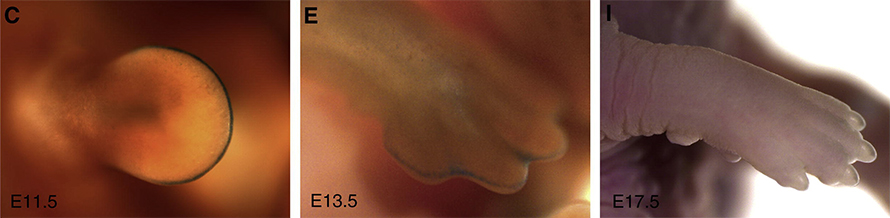 Senescent cells play a key role in early development, helping to sculpt limbs. This series of images shows the paw of an embryonic mouse as it develops from a round bud (left) to a mittenlike limb (center) to a complete foot (right). Senescent cells, stained blue, rim the tip of the developing paw in the first two panels, but disappear in the third as the animal nears birth.