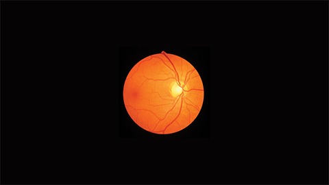 JLR: Sphingolipids and retinal degeneration