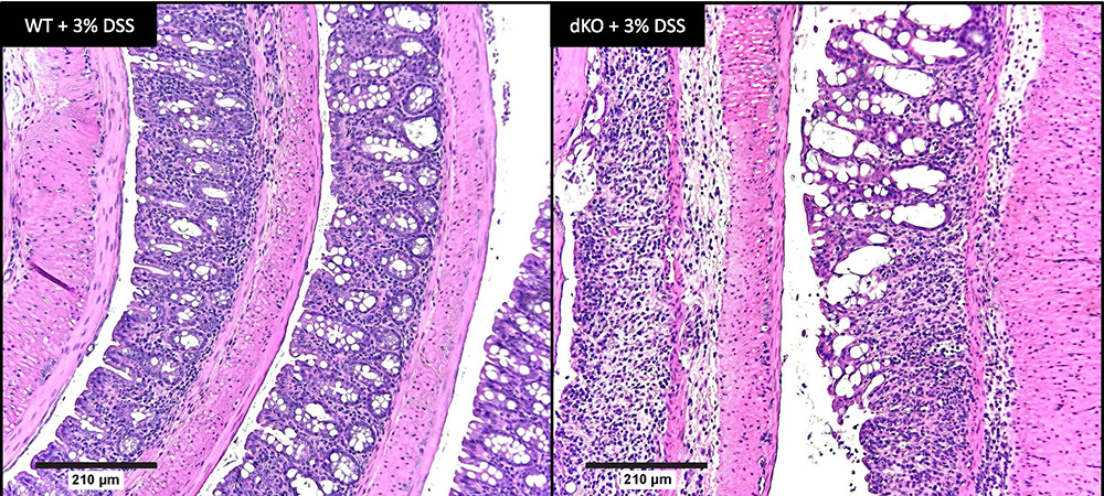 Micro image of colon tissue with colitis