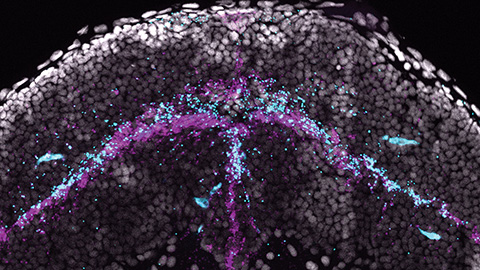 Zebrafish model links low omega-3s to eye abnormalities