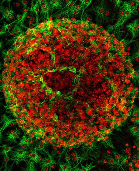 Astrocytes (green), seen here in a mouse, are star-shaped cells in the brain<br/>and spinal cord.