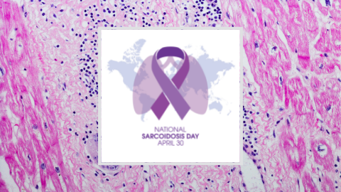 Finding sarcoidosis: A clinical game of hide and seek