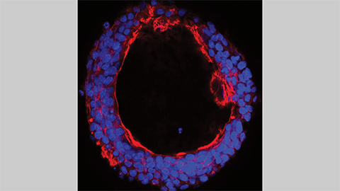 JBC: A sugar-attaching enzyme defines colon cancer