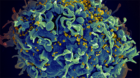 The sugar in semen makes HIV drugs less effective