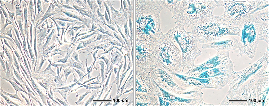 Changes in older cells allow scientists to identify them. As lab-grown cells age (right), they grow larger than young cells (left). Senescent cells produce more of an enzyme, beta-galactosidase, that scientists can stain blue.