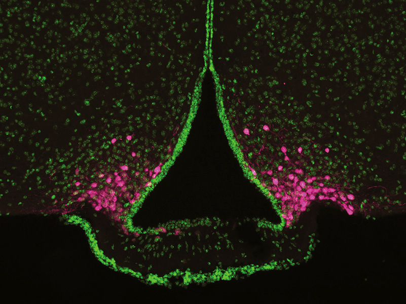 This microscopic image of a portion of the rodent brain highlights a set of cells known as AgRP neurons (stained magenta), which sit at the base of the hypothalamus. The cells are involved in appetite control; their position near the bloodstream allows them to easily to get signals about the body’s metabolic state.