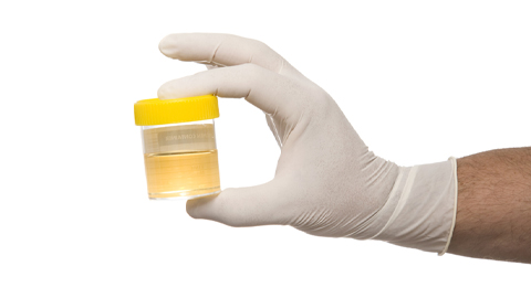 How chronic pain shows up in urine