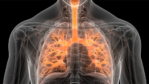 Detecting biomarkers for deadly lung disease