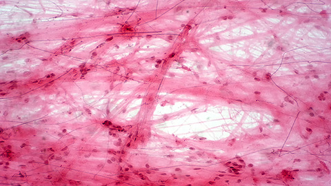 How sugars shape Marfan syndrome
