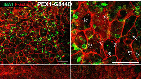 Early lipid changes drive retinal degeneration in Zellweger spectrum disorder