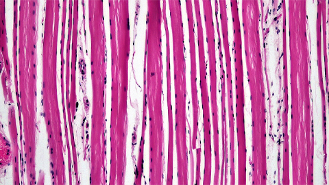Proteomic variation in heart tissues
