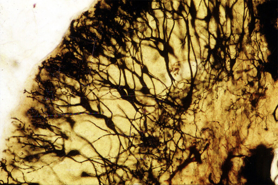 Top, Illustration of nerve cells in a rabbit hippocampus, from Golgi’s On the Detailed Anatomy of the Central Organs of the Nervous System, 1885. Bottom, Modern microphotograph by Carole Hackney of fusiform nerve cells using Golgi’s black reaction.