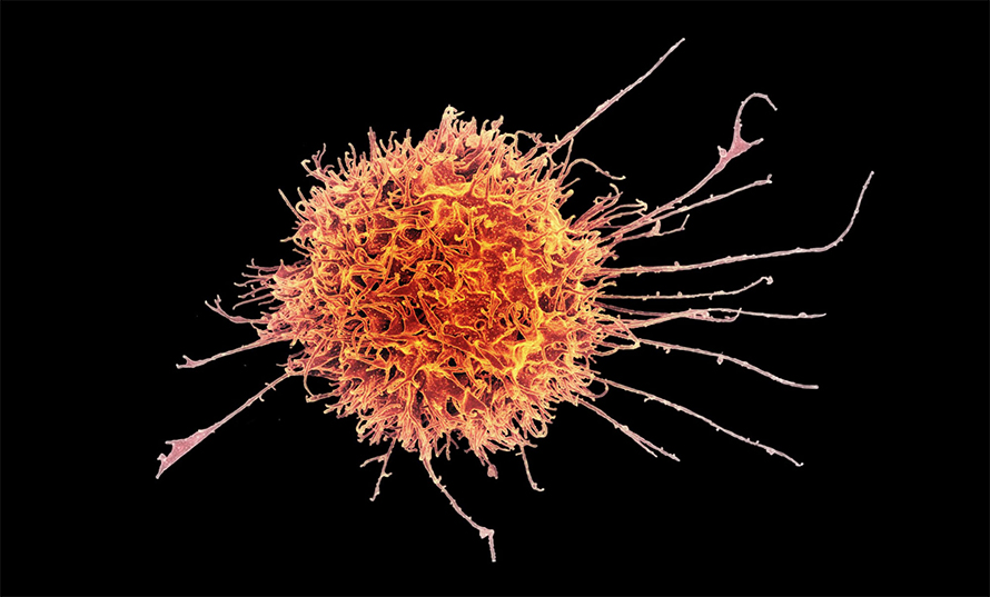 Colorized electron microscope image of of a human natural killer cell, one of many types of immune cells. Researchers suggest that due to the immune system’s response to stress, there is some logic underlying the idea that a regular meditation practice might help boost the immune system.